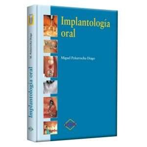 Peñarocha Implantología Oral 1 Tomo