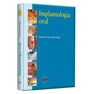 Peñarocha Implantología Oral 1 Tomo