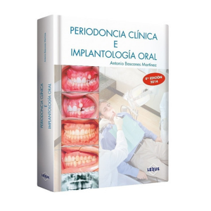 Periodoncia Clinica E Implantología Oral 4Ta Edición 1 Tomo