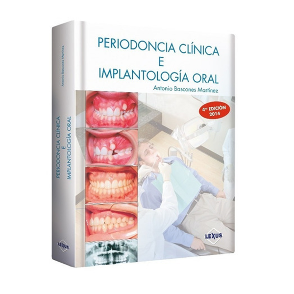 Periodoncia Clinica E Implantología Oral 4Ta Edición 1 Tomo