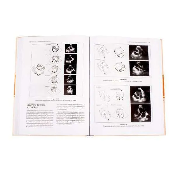 Manual De Medicina Y Cirugia Cardiorespiratorias En Pequeños Animales 1 Tomo - Imagen 3