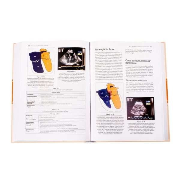 Manual De Medicina Y Cirugia Cardiorespiratorias En Pequeños Animales 1 Tomo - Imagen 4